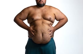 Concepto de obesidad.