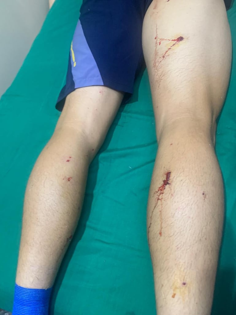 El futbolista Jonathan Vidal Ramos Benítez tuvo que ser hospitalizado tras el ataque de los barrabravas.