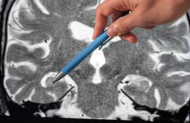 El hipocampo es una estructura del lóbulo temporal medial, presente en ambos hemisferios (izquierdo y derecho), ubicada hacia el interior del cerebro, cerca de regiones que procesan emociones y reconocimiento.