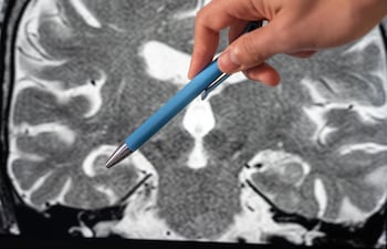 El hipocampo es una estructura del lóbulo temporal medial, presente en ambos hemisferios (izquierdo y derecho), ubicada hacia el interior del cerebro, cerca de regiones que procesan emociones y reconocimiento.