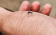 Concepto de picaduras de mosquitos.