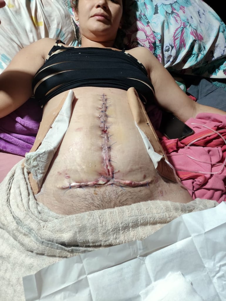 Jazmín Navarro fue sometida cuatro veces a cirugías a causa de un embarazo ectópico. Sus familiares y allegados denuncian negligencia.