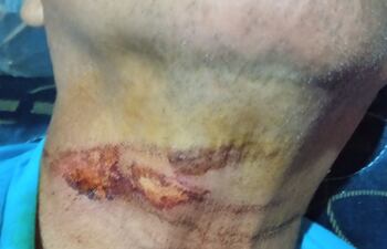 Víctima de Negligencia por parte de la Ande: José Benítez.