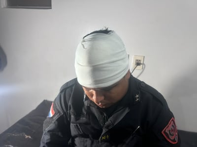 Policía fue herido con un machete durante intervención por violencia familiar en Luque