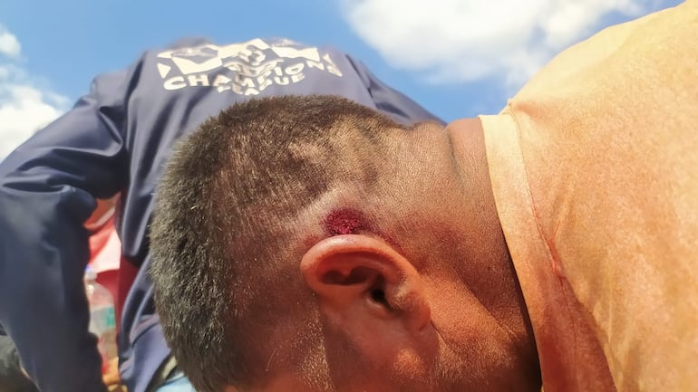 Heridos tras el enfrentamiento en la estancia. 