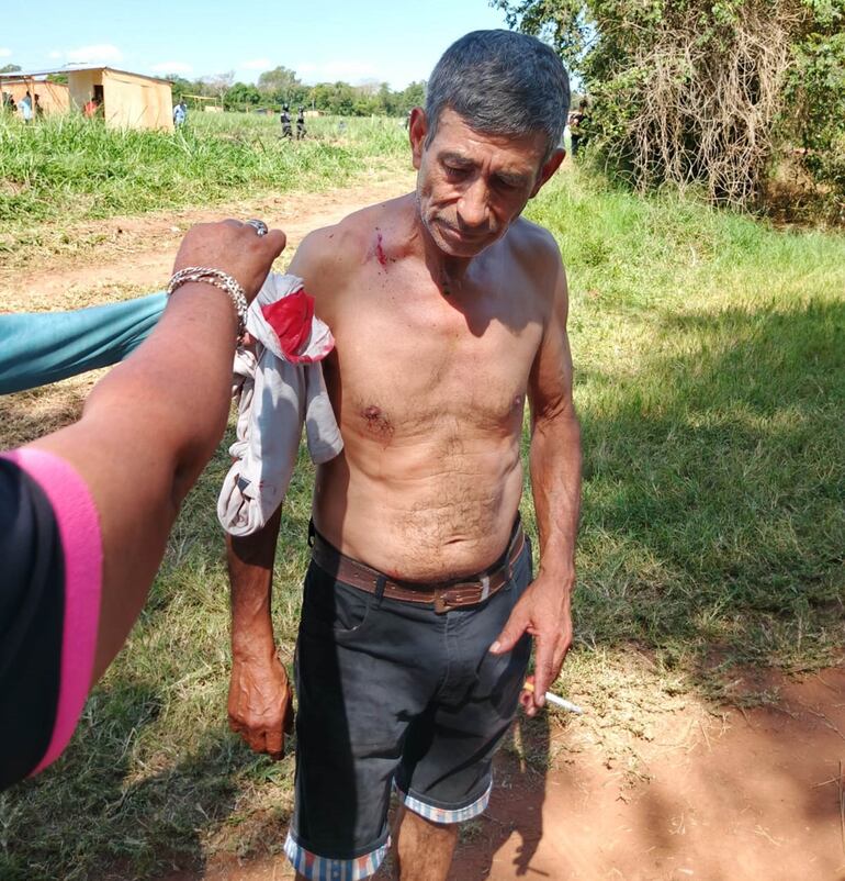 Un presunto invasor herido durante el enfrentamiento del martes 4 de noviembre.