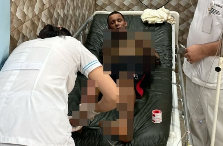 Richard Michael Aiub Ovando, fue trasladado inicialmente al Hospital Distrital y de allí lo remitieron al Hospital del Quemado, pero no resistió.