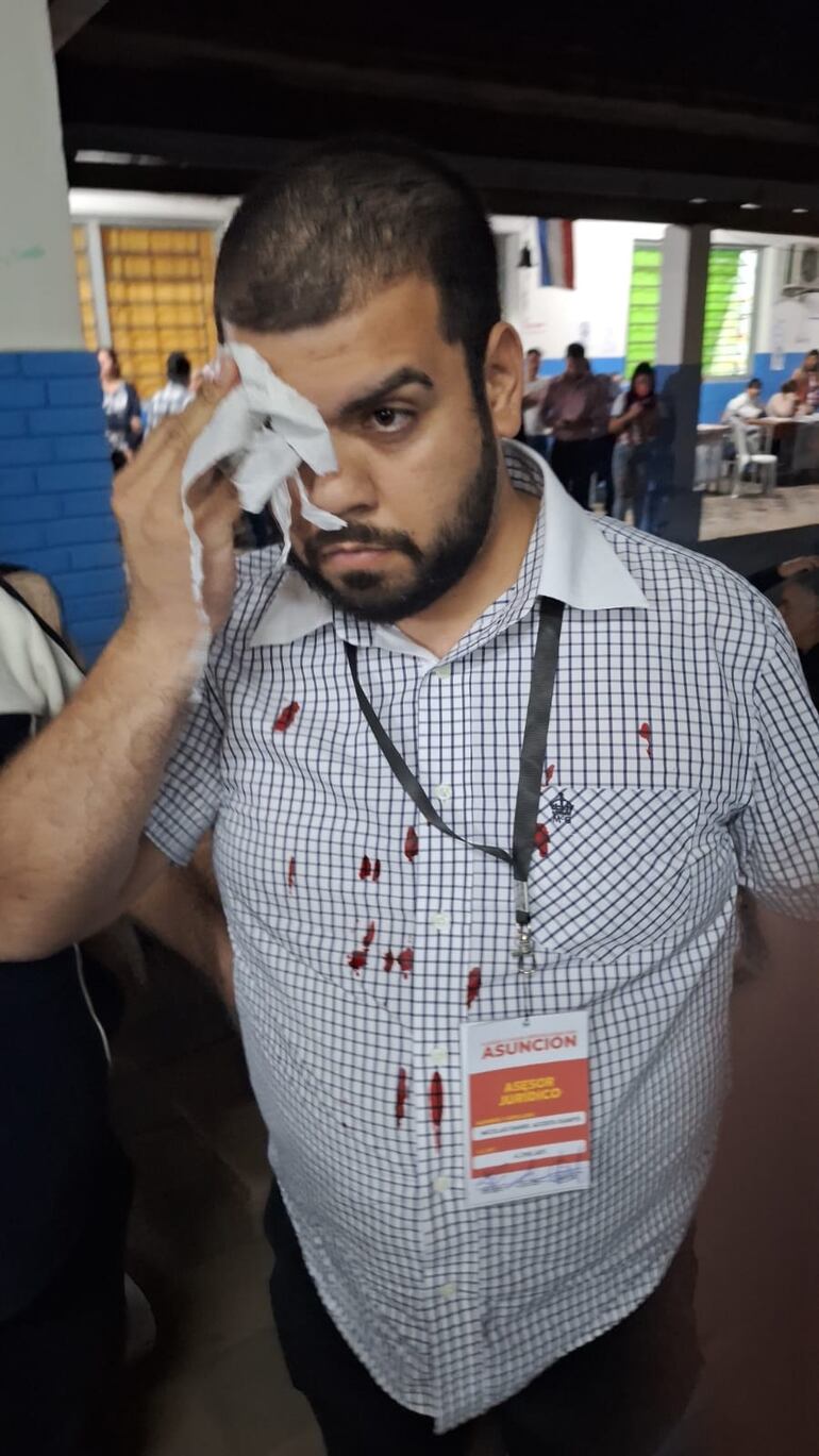 Internas ANR: incidente y denuncias contra el cartismo en Asunción - Política