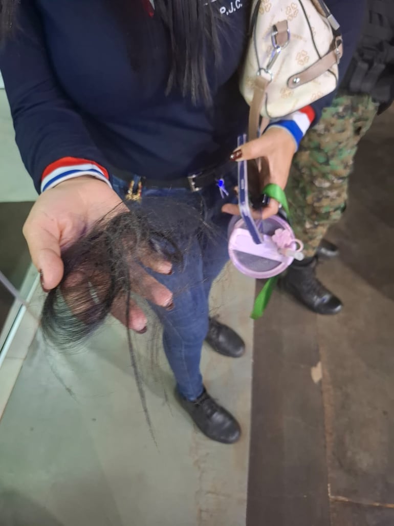 El agresor le arrancó el cabello a la víctima, según la denuncia.