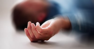 Concepto de epilepsia, convulsiones, etcétera.