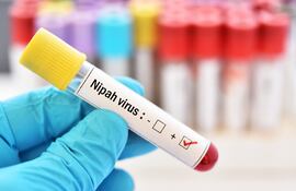 Virus Nipah