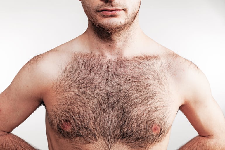 Hombre con mucho vello, imagen ilustrativa.