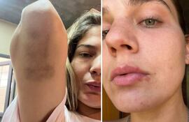 Una de las fotos que publicó Jannah Nebbeling, expareja del jugador paraguayo Jorge Báez.