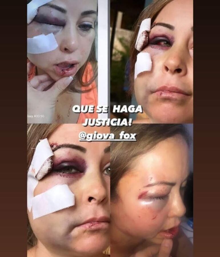 Mujer quedó prácticamente desfigurada tras la golpiza por parte de su expareja.