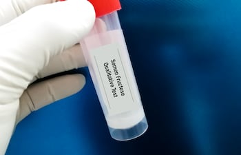 Concepto de análisis de semen.