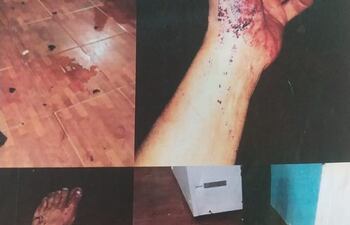 Las lesiones que tuvo Aida Sosa.