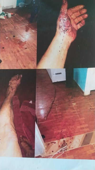 Las lesiones que tuvo Aida Sosa.