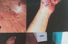 Las lesiones que tuvo Aida Sosa.