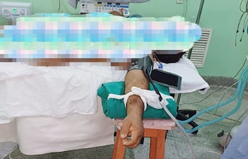 Un paciente es operado en una camilla utilizando butacas de madera como apoya brazos en el IMT.