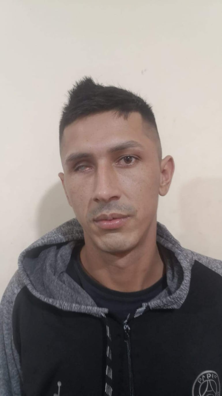 Hombre con sudadera gris y negra, expresión seria, un ojo visiblemente afectado, en un entorno interior simple.