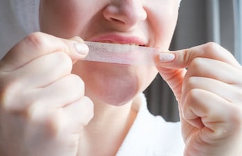 Qué pasa realmente cuando usás blanqueadores dentales sin control.