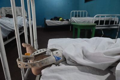 Paciente atado a una cama, en el Hospital Psiquiátrico.
