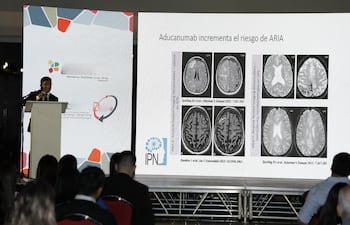 Una destacada trayectoria avala el trabajo del Dr. Nilton Custodio, quien vino a nuestro país para hablar sobre "Estrategias innovadoras del diagnóstico y tratamiento del Alzheimer".
