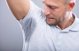 Hiperhidrosis o sudoración excesiva.