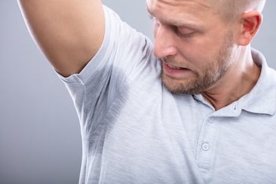 Hiperhidrosis o sudoración excesiva.