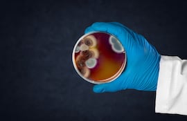 Prueba de resistencia a la susceptibilidad antimicrobiana por difusión en manos, imagen ilustrativa.