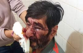 Don Jacinto Brítez, de Laurel, Canindeyú  víctima de una tremenda golpiza por parte de su hijo