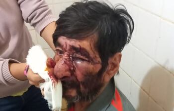 Don Jacinto Brítez, de Laurel, Canindeyú víctima de una tremenda golpiza por parte de su hijo