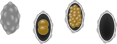 Prevención de la ascariasis.