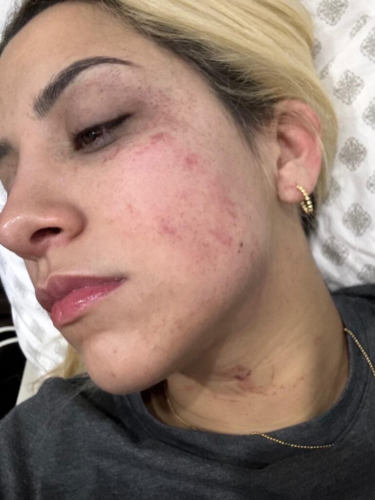 Imágenes delicadas: tras cuatro años de violencia, recién imputan a hombre por agredir a su esposa