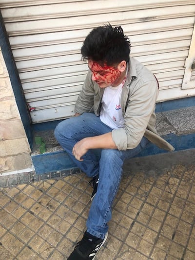 Guillermo Gill, funcionario de la ANDE herido en los incidentes en los alrededores del Congreso, durante las protestas contra el tratamiento de la ley que crea la Superintendencia de Jubilaciones.