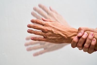 El Parkinson es una enfermedad crónica degenerativa neurológica que afecta al sistema motor del cuerpo, muchas veces provocando temblores y dificultades de movimiento.