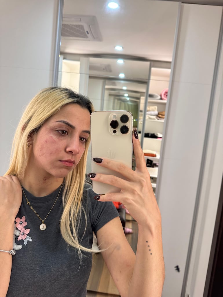 Lorena Segovia, víctima de violencia por parte de Cristian Vera, imputado por la Fiscalía.