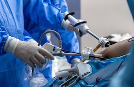 Cirugía bariátrica, imagen ilustrativa.