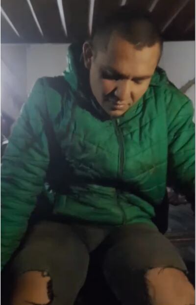 Oscar Iván Martínez Florentín se rompió ambas piernas al romperse el techo por el cual intentaba ingresar a una casa.