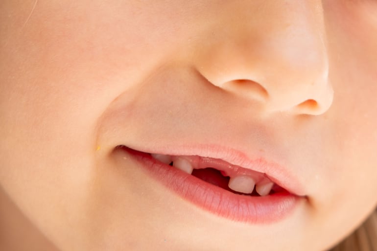 Concepto de dientes de leche.