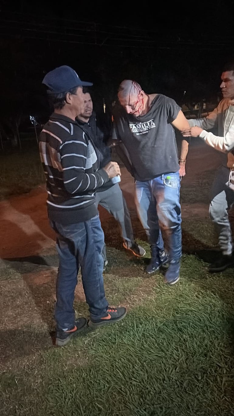 Uno de los agredidos anoche en donde estuvo involucrado el diputado Samaniego.