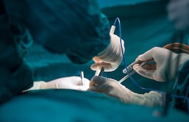 Operación en un quirófano.