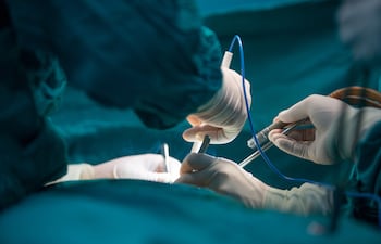 Operación en un quirófano.