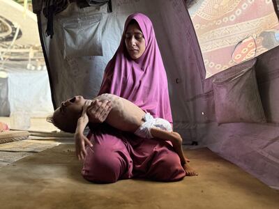 Mohamed Motawaq, de 18 meses, en brazos de su madre, Hidaya al Motawaq.