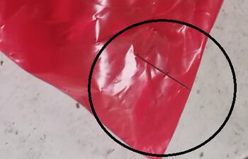 En el círculo, la aguja de la jeringa de residuo patológico que clavó al recolector.