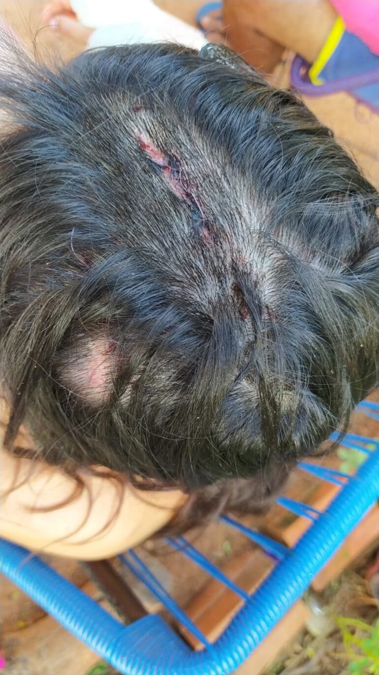 La víctima quedó con varias heridas también en la cabeza