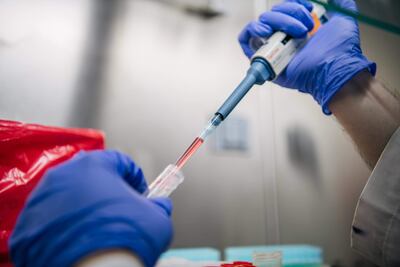 El técnico de laboratorio Julio Vásquez aísla muestras de COVID-19 en el laboratorio de diagnóstico Genview el 13 de agosto de 2021 en Houston, Texas. En toda el área metropolitana de Houston, las pruebas han aumentado significativamente a medida que la variante Delta abruma a los hospitales y las escuelas y las empresas continúan reabriendo.