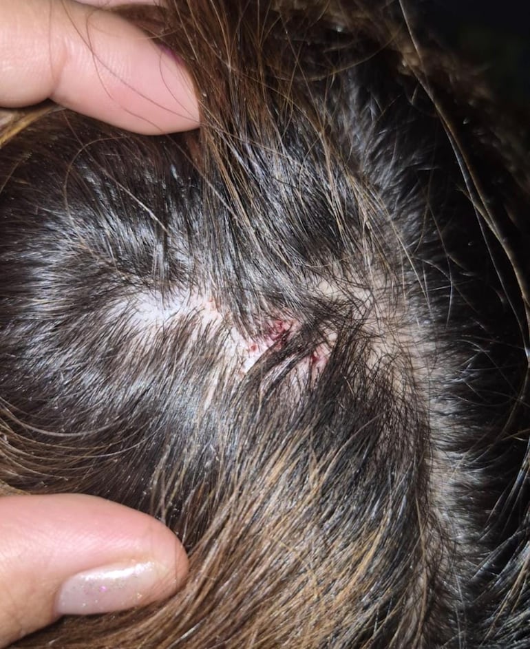 Video: acusan a un joven por agresión doméstica