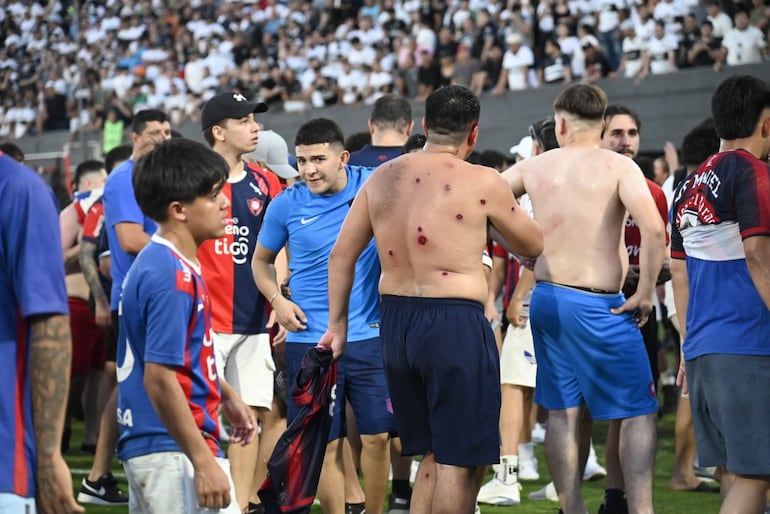 La impactantes imágenes del Superclásico que terminó en emergencia humanitaria