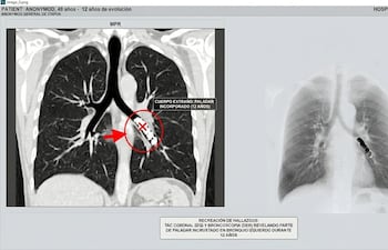 Imagen generada con IA recrea el resultado de la TAC realizada al paciente